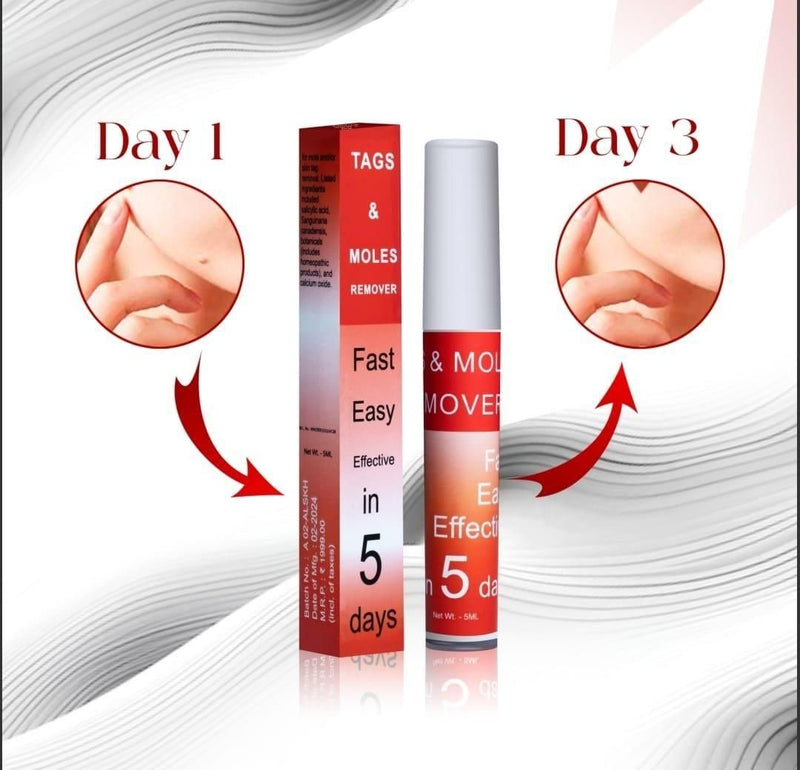 Tags & Moles Remover Buy 1 Get 1 FREE